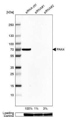 Western Blot: PAK4 Antibody [NBP2-56634]