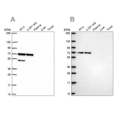 Western Blot: PAK4 Antibody [NBP2-56634]