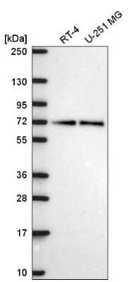 Western Blot: PAK4 Antibody [NBP2-58833]