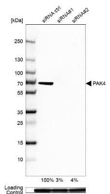 Western Blot: PAK4 Antibody [NBP2-58833]