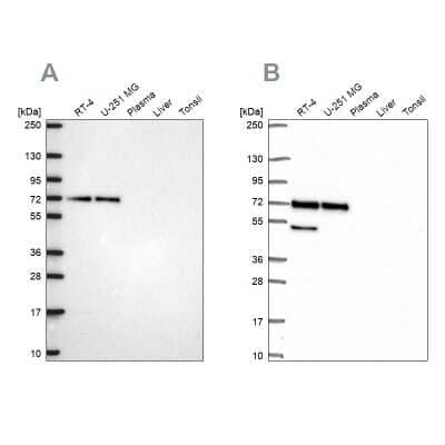 Western Blot: PAK4 Antibody [NBP2-58833]