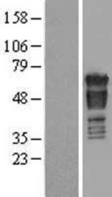 Western Blot: PAK4 Overexpression Lysate [NBL1-14080]