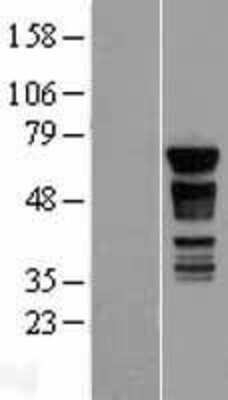 Western Blot: PAK4 Overexpression Lysate [NBL1-14081]