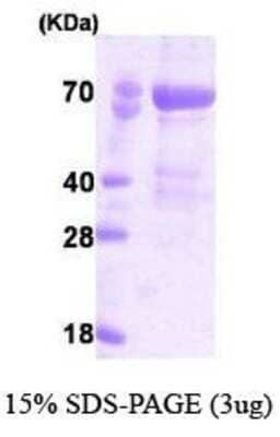 SDS-PAGE: Recombinant Human PAK4 His Protein [NBC1-18517]