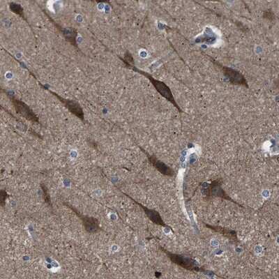 Immunohistochemistry-Paraffin: PAK7 Antibody [NBP1-89609]
