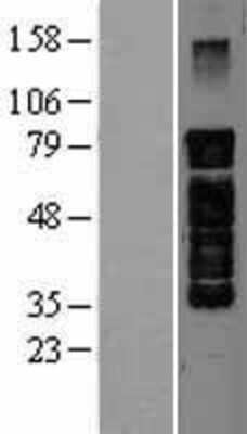 Western Blot: PAK7 Overexpression Lysate [NBL1-14084]