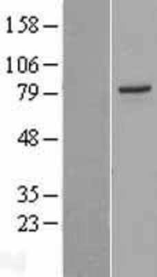 Western Blot: PAK7 Overexpression Lysate [NBL1-14085]