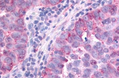 Immunohistochemistry-Paraffin: PAK6 Antibody - BSA Free [NLS6942]