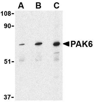 Western Blot: PAK6 AntibodyBSA Free [NBP1-76632]