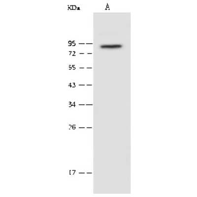 Western Blot: PAK6 Antibody [NBP2-99551]