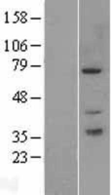 Western Blot: PAK6 Overexpression Lysate [NBL1-14083]