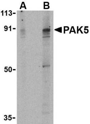 Western Blot: PAK7 AntibodyBSA Free [NBP1-77237]