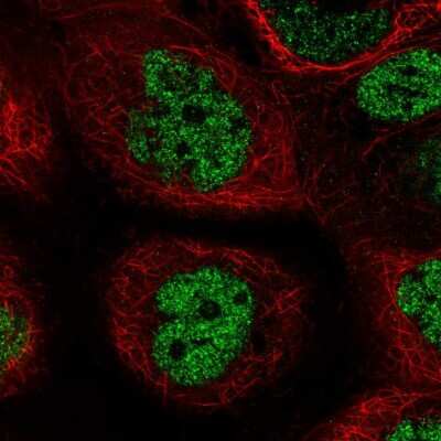 Immunocytochemistry/ Immunofluorescence: PALB2 Antibody [NBP2-55028]