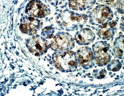 Immunohistochemistry-Paraffin: PALB2 Antibody [NBP3-12329]