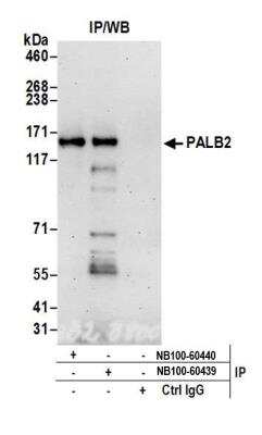 Immunoprecipitation: PALB2 Antibody [NB100-60439]
