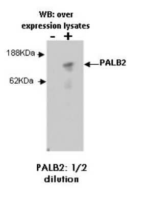 Western Blot: PALB2 Antibody (M41-P3F3)BSA Free [NBP2-50232]