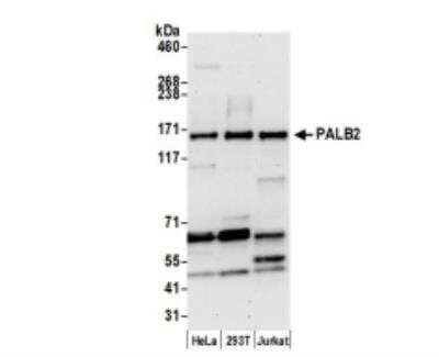 Western Blot: PALB2 Antibody [NB100-60439]