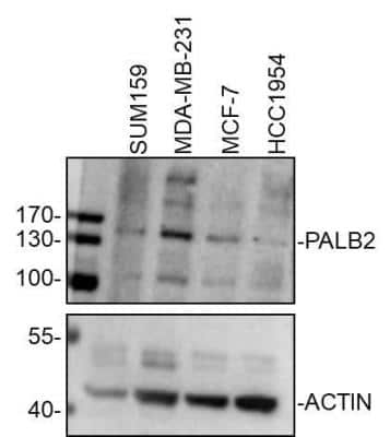 Western Blot: PALB2 Antibody [NB100-60439]