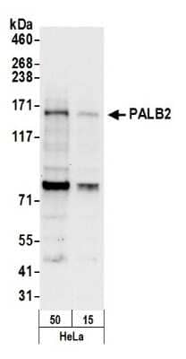 Western Blot: PALB2 Antibody [NB100-60440]