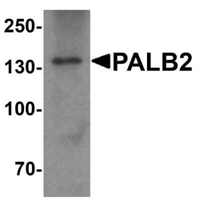 Western Blot: PALB2 AntibodyBSA Free [NBP1-76317]