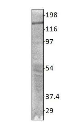 Western Blot: PALB2 Antibody [NBP3-12329]