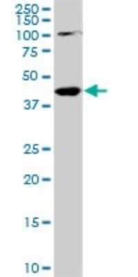 Western Blot: PALM2 Antibody (1A8) [H00114299-M09]