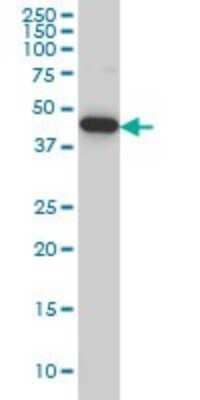 Western Blot: PALM2 Antibody (1A8) [H00114299-M09]