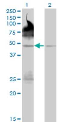 Western Blot: PALM2 Antibody (1A8) [H00114299-M09]