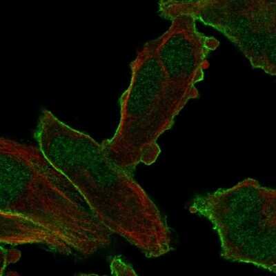 Immunocytochemistry/ Immunofluorescence: PALM2 Antibody [NBP2-56414]