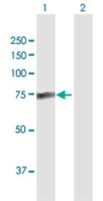 Western Blot: PALM2 Antibody [H00114299-D01P]