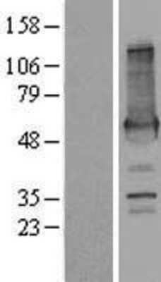 Western Blot: AKAP2 Overexpression Lysate [NBP2-08551]