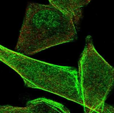 Immunocytochemistry/ Immunofluorescence: PALMD Antibody [NBP1-88481]