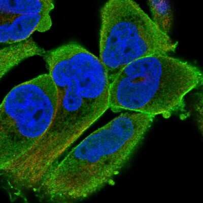 Immunocytochemistry/ Immunofluorescence: PALMD Antibody [NBP2-55156]