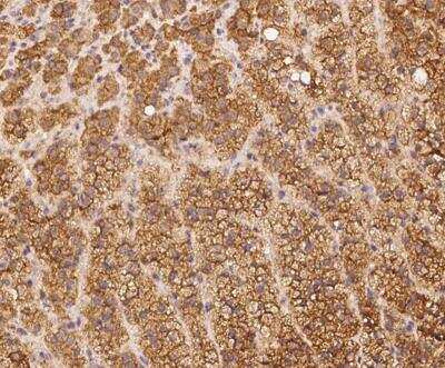 Immunohistochemistry-Paraffin: PALMD Antibody [NBP3-12598]