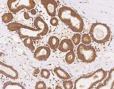 Immunohistochemistry-Paraffin: PALMD Antibody [NBP3-12598]
