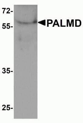 Western Blot: PALMD AntibodyBSA Free [NBP2-82018]