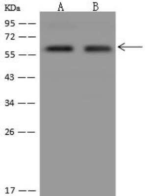 Western Blot: PALMD Antibody [NBP3-12598]