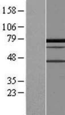 Western Blot: PALMD Overexpression Lysate [NBL1-14089]