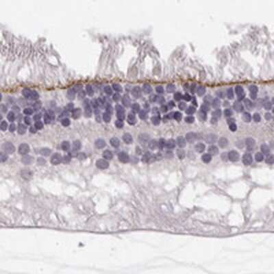 Immunohistochemistry-Paraffin: PALS1/MPP5 Antibody [NBP2-68812]