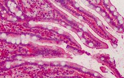 Immunohistochemistry-Paraffin: PALS1/MPP5 Antibody [NB300-952]
