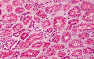 Immunohistochemistry-Paraffin: PALS1/MPP5 Antibody [NB300-952]