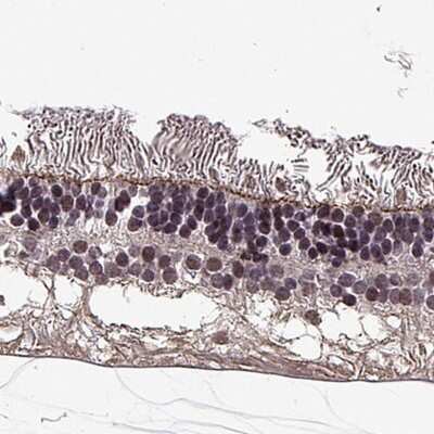 Immunohistochemistry-Paraffin: PALS1/MPP5 Antibody [NBP1-83716]