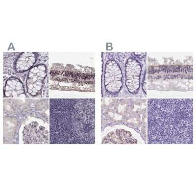 Immunohistochemistry-Paraffin: PALS1/MPP5 Antibody [NBP1-83716]