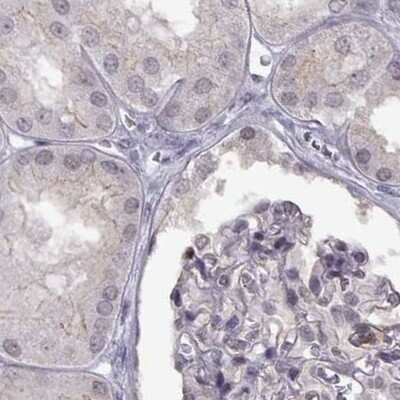 Immunohistochemistry-Paraffin: PALS1/MPP5 Antibody [NBP1-83716]