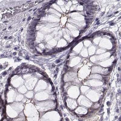 Immunohistochemistry-Paraffin: PALS1/MPP5 Antibody [NBP1-83716]