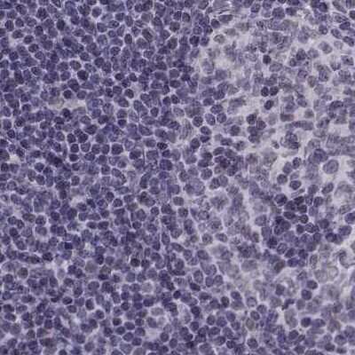 Immunohistochemistry-Paraffin: PALS1/MPP5 Antibody [NBP1-83716]