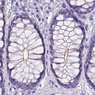 Immunohistochemistry-Paraffin: PALS1/MPP5 Antibody [NBP2-68812]
