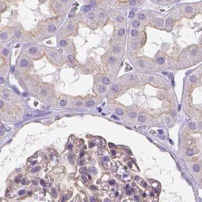 Immunohistochemistry-Paraffin: PALS1/MPP5 Antibody [NBP2-68812]