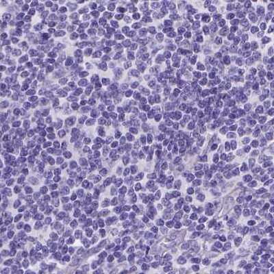 Immunohistochemistry-Paraffin: PALS1/MPP5 Antibody [NBP2-68812]