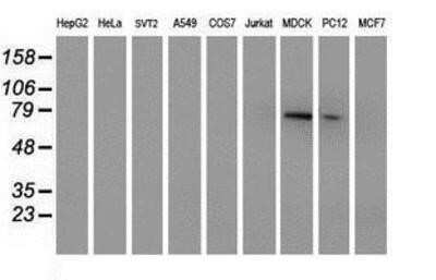Western Blot: PALS1/MPP5 Antibody (OTI2D3)Azide and BSA Free [NBP2-73234]